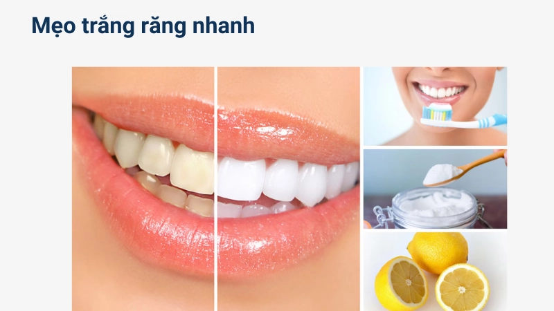 Mẹo làm trắng răng cấp tốc từ nhà bếp