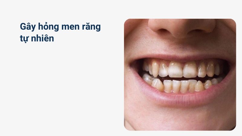 Cảnh báo phương pháp tự nhiên gây hỏng men