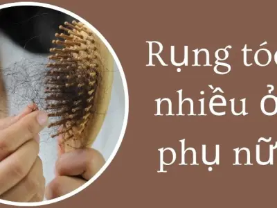 Rụng tóc nhiều ở phụ nữ khiến da đầu yếu đi từng ngày
